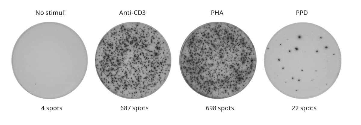 T cell ELISpot