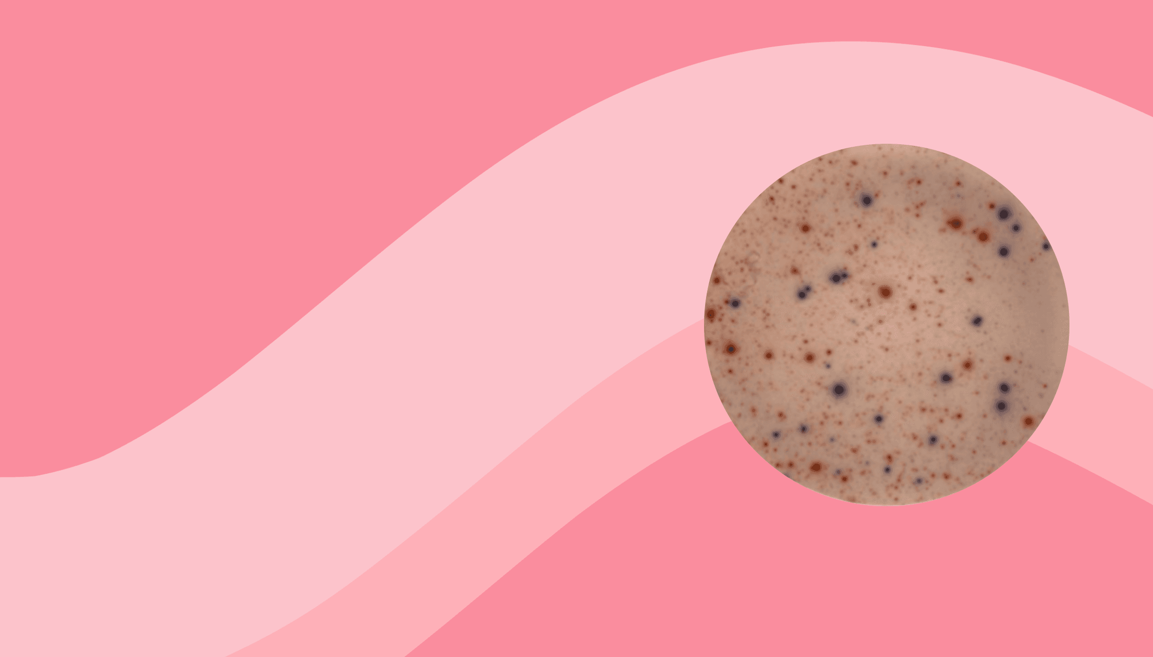 Blog header image