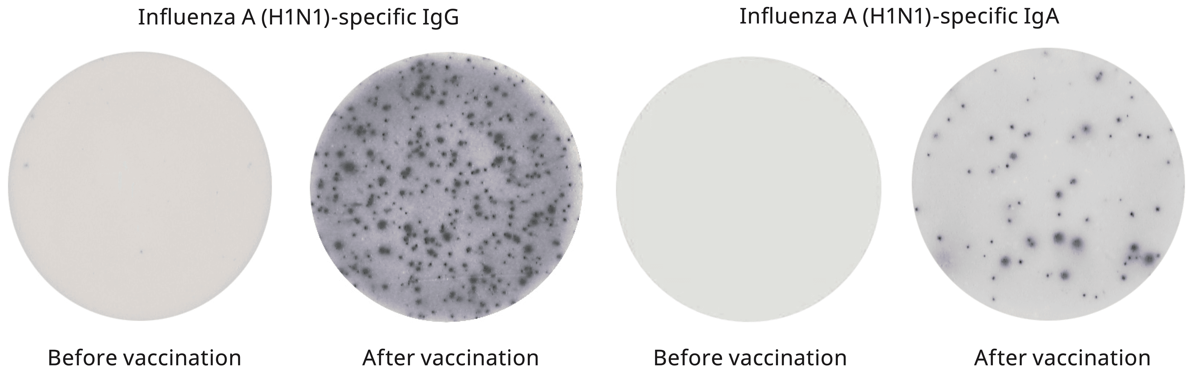 Human IgG and IgA ELISpot