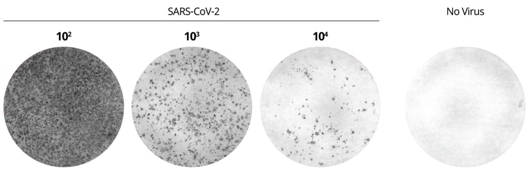 SARS-CoV-2 FociSpot virus titration