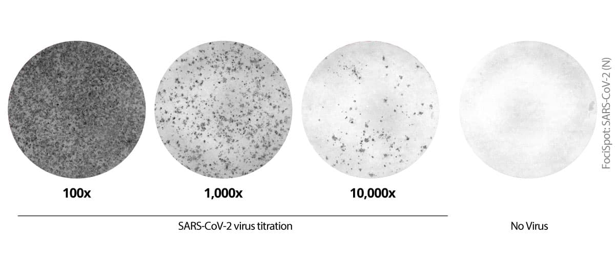 FociSpot immunostaining of SARS-CoV-2 nucleocapsid in infected Vero cells. Vero E6 cells were infected with the SARS-CoV-2 virus (titrated). After fixation and permeabilization, foci were detected using anti-SARS-CoV-2 (N) mAb MTCC25, followed by Streptavidin-ALP and BCIP/NBT-plus substrate. Foci were counted using the Apex software in Mabtech IRIS 2.