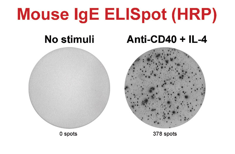 Mouse IgE ELISpot Mouse IgE ELISpot