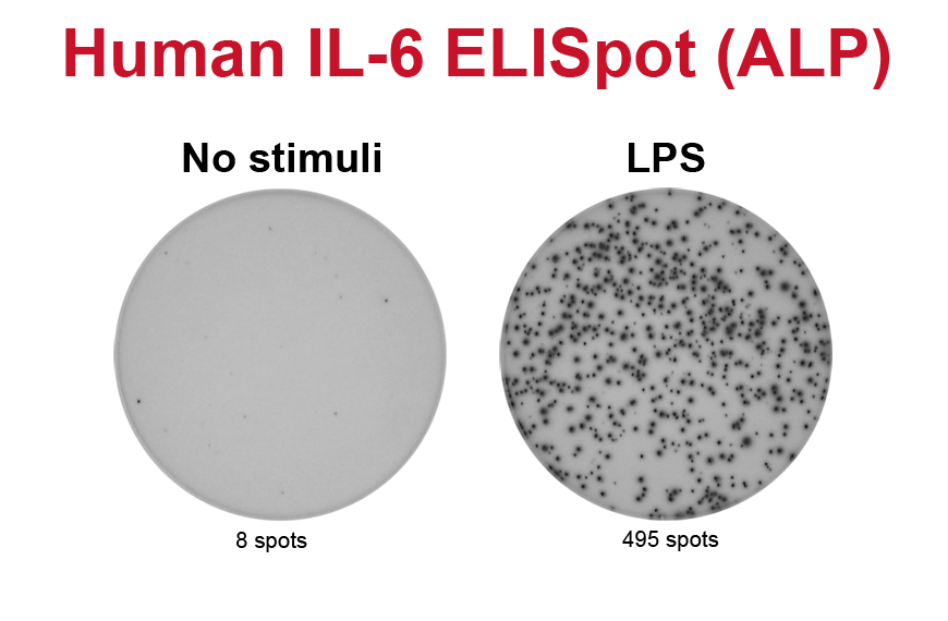 elispot assay principle To explore the utility of the multiplexed elispot assay, control cell populations were established that show different phenotypic in principle, this capability. elispot assay principle To explore the utility of the multiplexed elispot assay, control cell populations were established that show different phenotypic in principle, this capability.